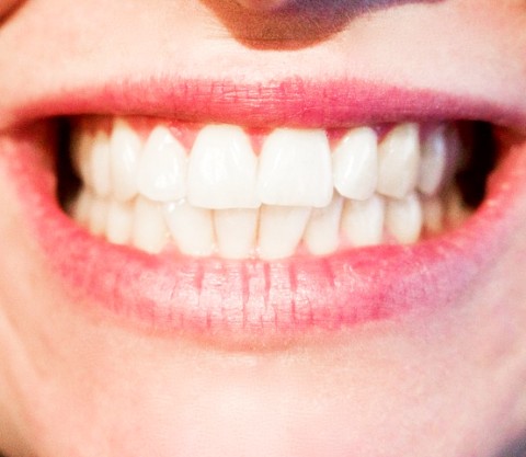 オススメの電動歯ブラシ