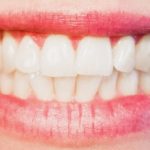 口臭が気になるなら【オススメの口腔洗浄器】人気＆売れ筋ランキング・トップ６