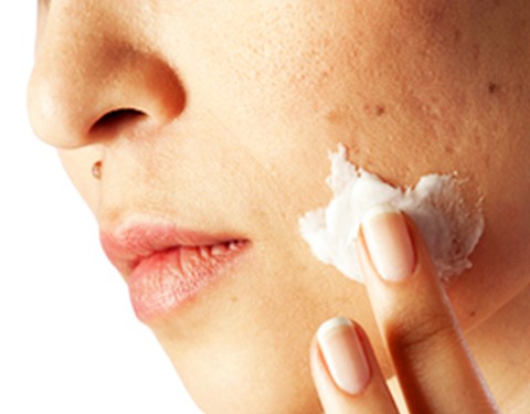 顔イボのケア