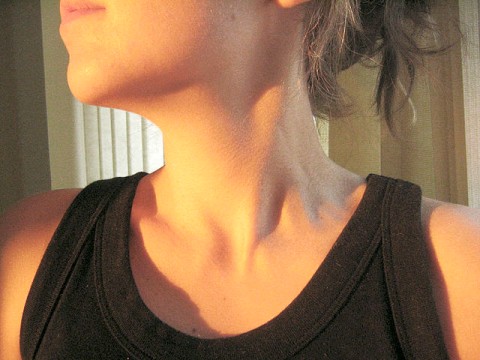 首にできるイボ